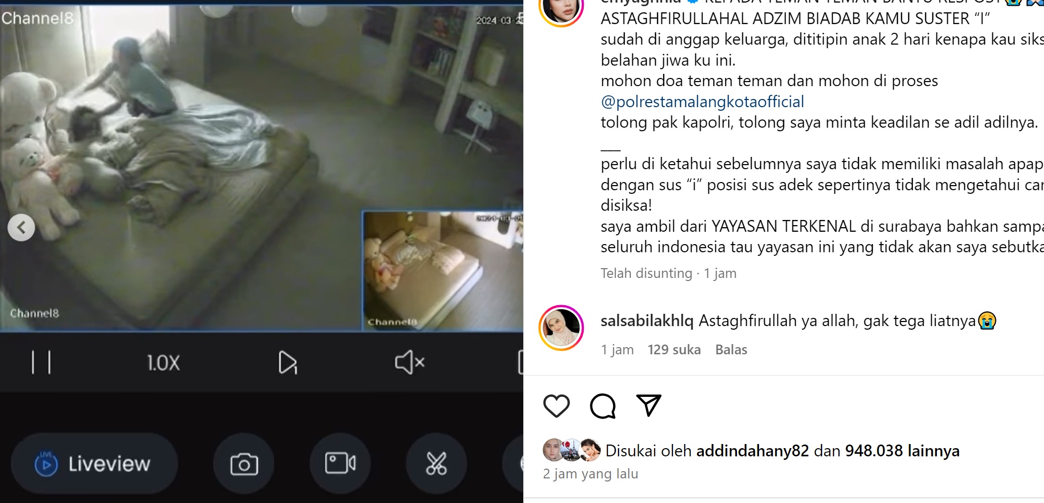 Baby Sister Siksa Anak Influencer Aghnia, Mata Kiri Bengkak