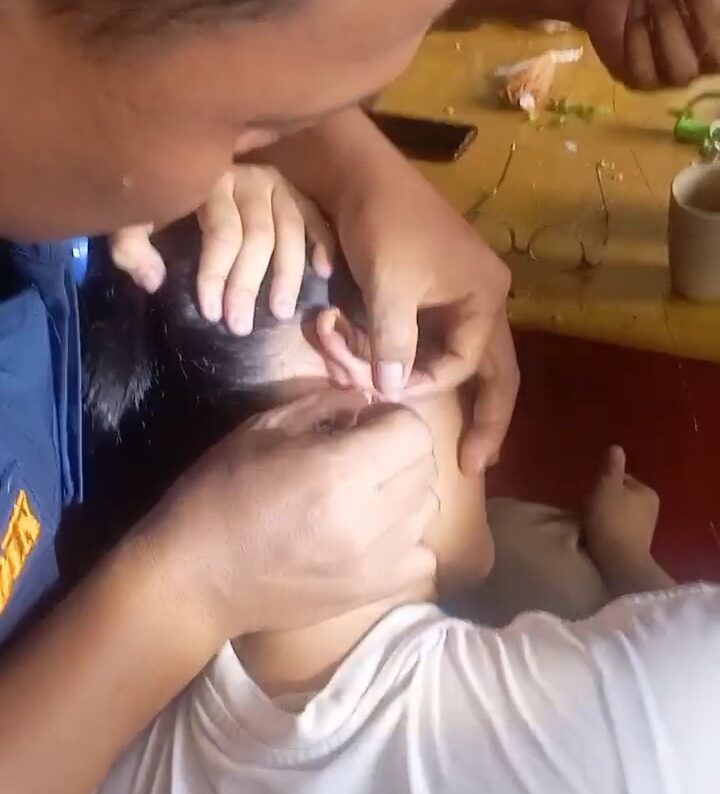 Anting Terselip di Telinga Warga, BPBD Kota Tangerang Dimintai Pertolongan Anting Terselip di Telinga Warga, BPBD Kota Tangerang Dimintai Pertolongan